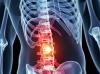 Photo for Global Spinal Trauma Devices Market 2020 | Manufacturers Regions Type And Application Forecast To 2025
