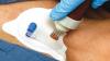 Photo for Global Intraosseous Infusion Devices Market Research Report - Industry Analysis, Size, Share, Growth, Trends and Forecast Till 2026