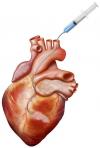 Photo for Global Myocardial Infarction Therapeutics Market Research Report - Industry Analysis, Size, Share, Growth, Trends and Forecast Till 2026