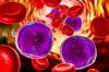 Photo for Global Acute Lymphocytic Leukemia Therapeutics Market Research Report - Industry Analysis, Size, Share, Growth, Trends and Forecast Till 2026