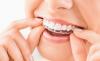 Photo for Dental Braces in Islamabad