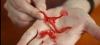 Photo for Global Artificial Blood Vessel Market 2020 | Manufacturers Regions Type And Application Forecast To 2025