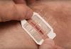 Photo for Wound Closures Devices Market | World Players Forecast Analysis Till 2023