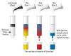 Photo for Solid Phase Extraction (SPE) Market | World Players Forecast Analysis Till 2025