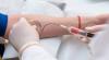 Photo for Global Blood Collection Market 2020 | Manufacturers, Regions, Type And Application, Forecast To 2025