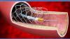 Photo for Global Peripheral Vascular Devices Market 2020 | Manufacturers Regions Type And Application Forecast To 2025