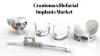 Photo for Cranio Maxillofacial Implants Market | World Players Forecast Analysis Till 2025