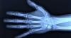 Photo for Global Diagnostic X-Ray Imaging Market 2020 | Manufacturers Regions Type And Application Forecast To 2025