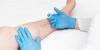Photo for Global Sclerotherapy Market 2020 | Manufacturers Regions Type And Application Forecast To 2025