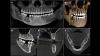 Photo for Global Dental CBCT Market 2020 | Manufacturers Regions Type And Application Forecast To 2025