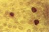 Photo for Chlamydia Trachomatis Antigens