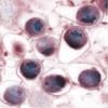 Photo for Chlamydophila Pneumoniae Antigens