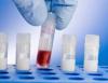Photo for Global Tissue Banking Market 2020 | Manufacturers Regions Type And Application Forecast To 2025