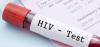 Photo for HIV Testing Market Analysis Focusing On Application, Types And Regional Outlook 2020-2024