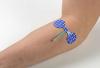 Photo for Global Medical Electrodes Market 2020 | Manufacturers Regions Type And Application Forecast To 2025