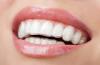 Photo for Global Invisible Braces Market 2020 | Manufacturers Regions Type And Application Forecast To 2025