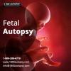 Photo for Fetal Autopsy