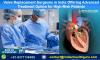 Photo for Best Heart Valve Replacement Surgeons In India