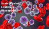Photo for Acute Myeloid Leukemia Therapeutics Market | World Players Forecast Analysis Till 2025