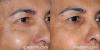 Photo for San Diego Botox San Diego