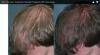 Photo for San Diego Hair Transplant