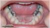 Photo for Cherry Hills Dental Associates, PLLC