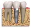 Photo for Crown Dental