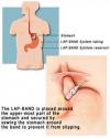 Photo for Effective Weight Reduction