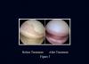 Photo for Dr. Jack Bert, MD Minnesota Bone & Joint Specialists