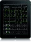Photo for Remote Patient Monitoring Devices Market Expected to Reach USD 0.98 Billion Globally in 2020