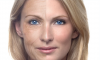 Photo for Anti Wrinkle Treatment